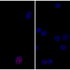 Progeria mouse fibroblast cells rejuvenated by partial reprogramming.